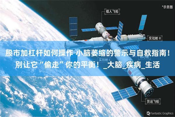 股市加杠杆如何操作 小脑萎缩的警示与自救指南！别让它“偷走”你的平衡！_大脑_疾病_生活
